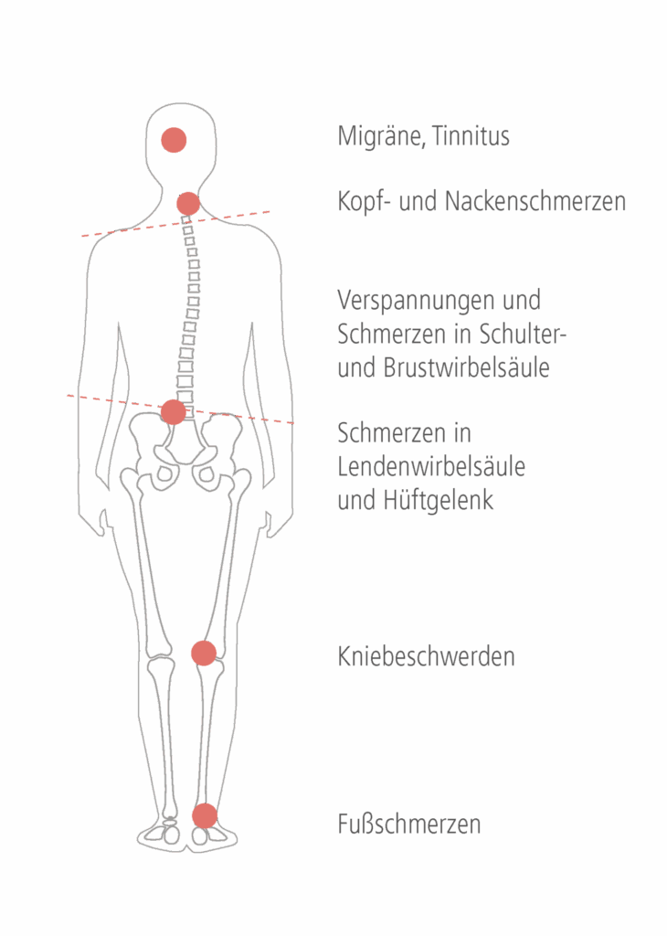 CMD Funktionsanalyse